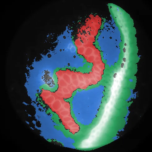 A Convallaria section coloured by the phasor clusters of its pixels